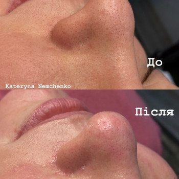 Фото с портфолио Катерина Немченко