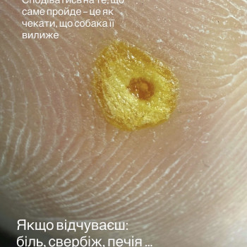«болючамозоль