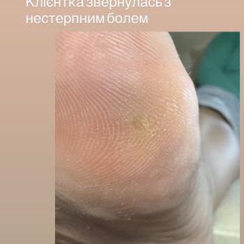 подолог кривий ріг # кривийрігпожолог