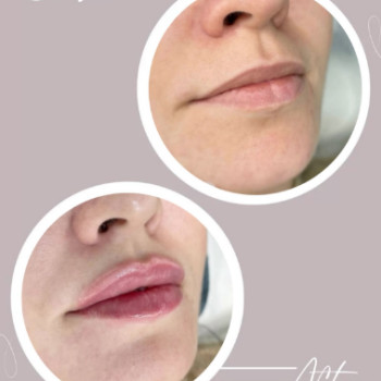 Фото с портфолио Healthy & beauty club