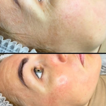 Фото с портфолио Perfect Skin