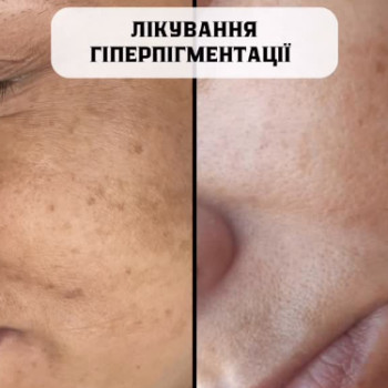 Фото с портфолио Perfect Skin