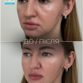 Фото с портфолио Dr. Galatska clinic