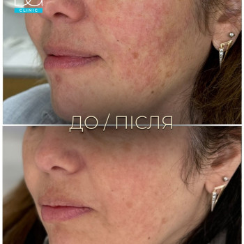 Фото с портфолио Dr. Galatska clinic