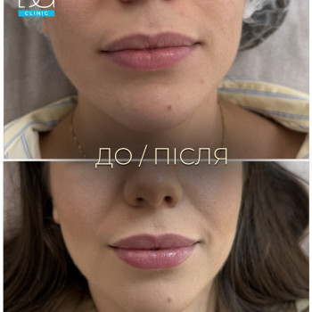 Фото с портфолио Dr. Galatska clinic