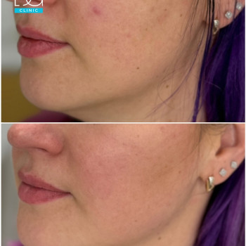 Фото с портфолио Dr. Galatska clinic