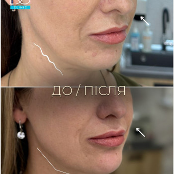 Фото с портфолио Dr. Galatska clinic