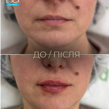 Фото с портфолио Dr. Galatska clinic