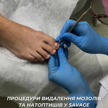 Фото с портфолио Savage