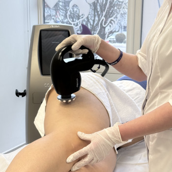 Уніполярний RF-ліфтинг Uni Body. RF-ліфтинг нового покоління. Унікальна частота 40.68 мгц . Запатентована технологія ALMA LASER. Найбільша потужність та найглибше проникнення серед усіх існуючих RF технологій, що можливе на сьогодні.