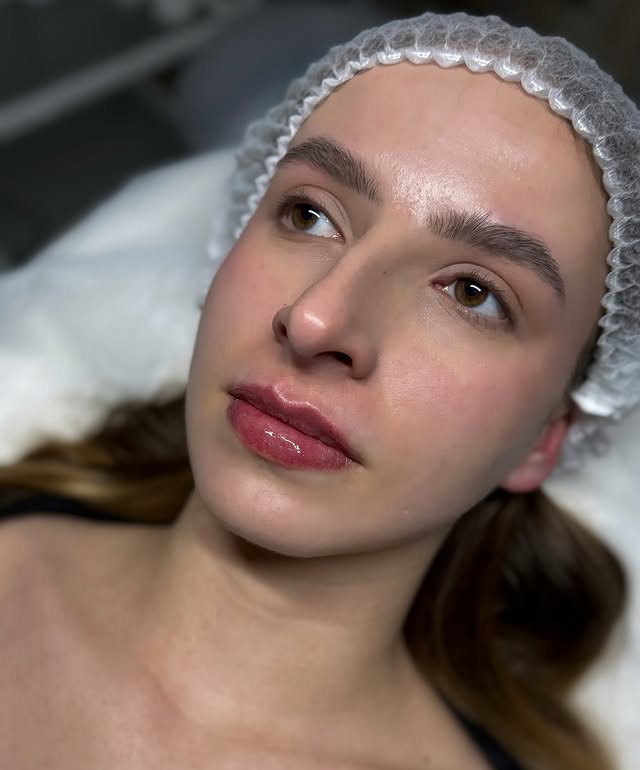 Увеличение губ контурная пластика аугментация, фото - Врач-косметолог Дана Гуртова