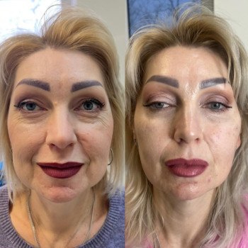Фото с портфолио Маргарита Перченко