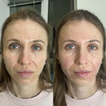 Фото с портфолио Маргарита Перченко
