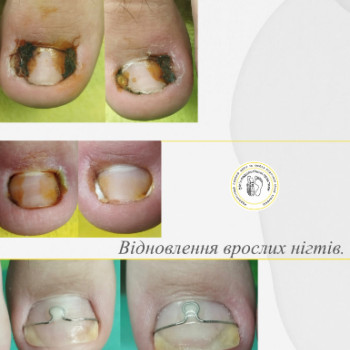 Фото с портфолио Галина Фрадкіна