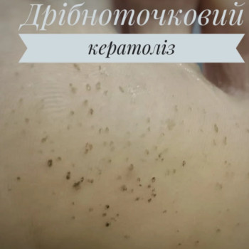 Фото с портфолио Ольга Буваева