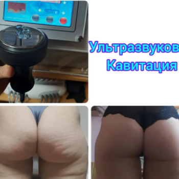 Фото с портфолио Центр апаратної корекції фігури «Slim»