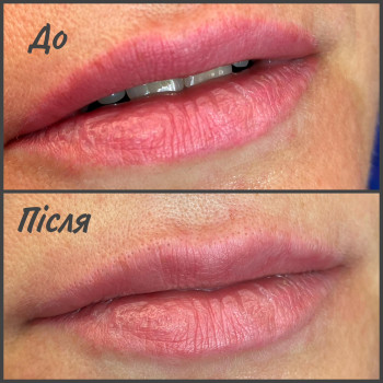 Фото с портфолио Оксана Ткаченко