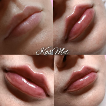 Фото с портфолио KOSMET