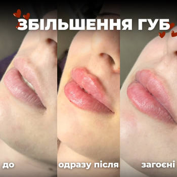 Фото с портфолио Надiя
