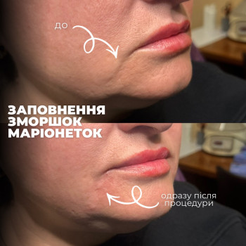 Фото с портфолио Надiя