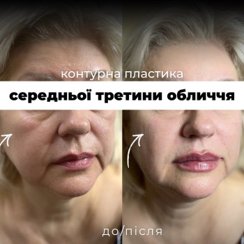 Фото с портфолио Надiя