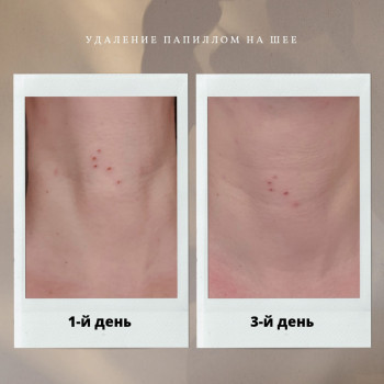 Фото с портфолио Елена Ласка