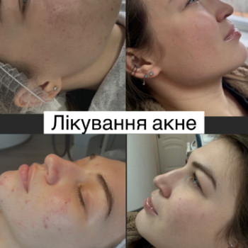 Фото с портфолио Олена Молоканова