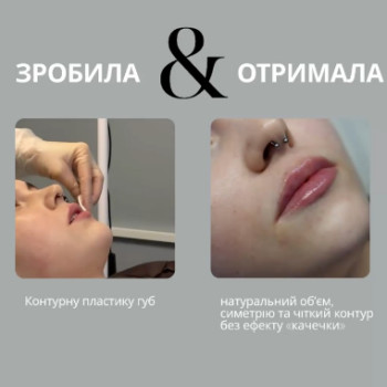 Фото с портфолио Віталіна Рудик