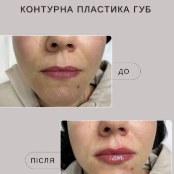 Фото с портфолио Віталіна Рудик