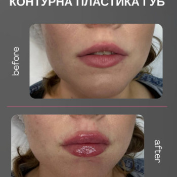 Фото с портфолио Віталіна Рудик