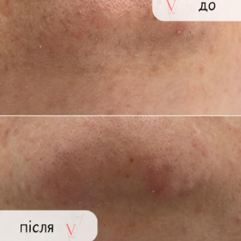 Фото с портфолио Вікторія Бойправ