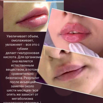 Фото с портфолио Екатерина Стельмашенко