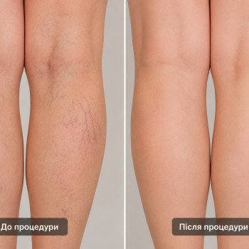 Фото с портфолио Центр лазерної косметології