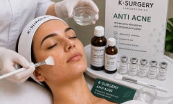 Anti Acne пілінг Студия лазерной эпиляции Центр лазерної косметології Луцк