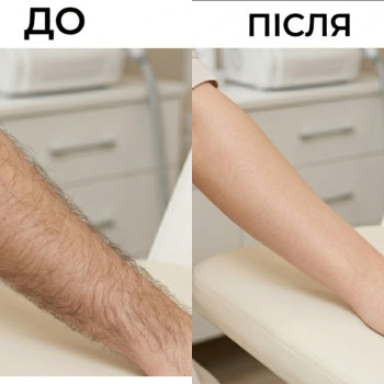 Шугаринг рук