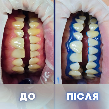 Фото с портфолио Vlasov