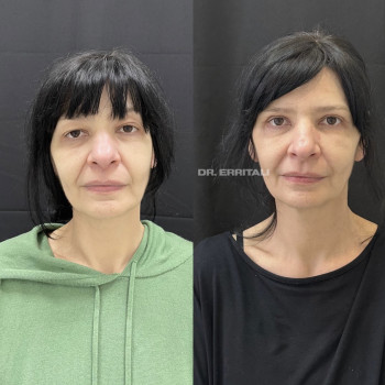 Фото с портфолио Абдель Эрритали