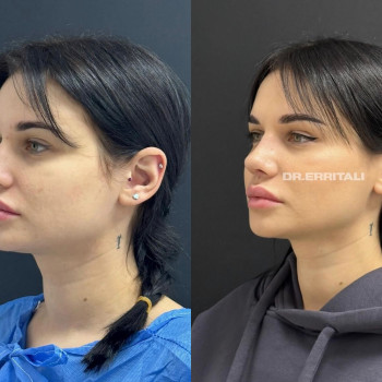 Фото с портфолио Абдель Эрритали