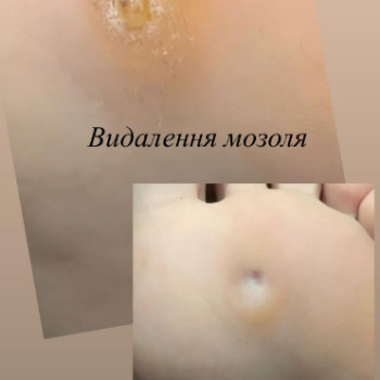 Фото с портфолио Галина Франчук