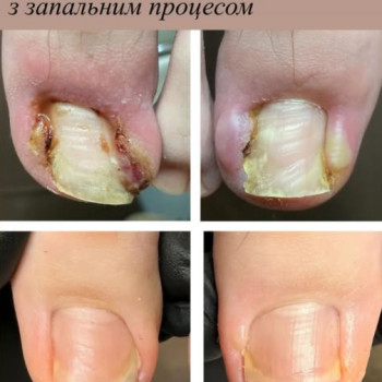 Фото с портфолио Галина Франчук