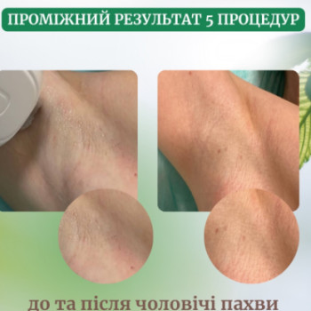 Фото с портфолио Центр краси і здоров'я Авіценна Естетик