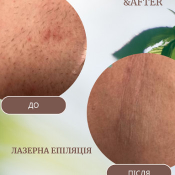 Фото с портфолио Центр краси і здоров'я Авіценна Естетик