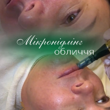 Фото с портфолио Центр красоты и здоровья «Авиценна Эстетик