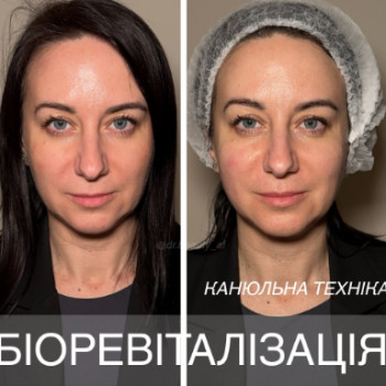 Фото с портфолио Аліна Фучеджи