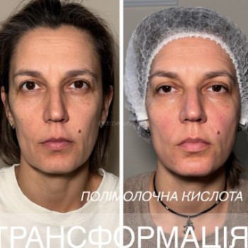 Фото с портфолио Аліна Фучеджи