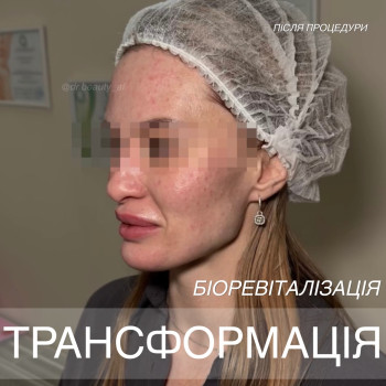 Фото с портфолио Аліна Фучеджи