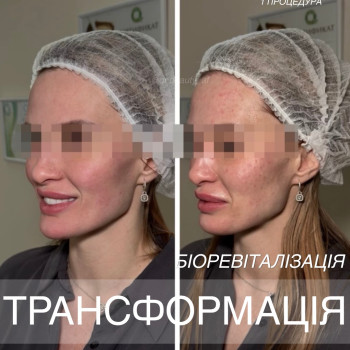 Фото с портфолио Аліна Фучеджи
