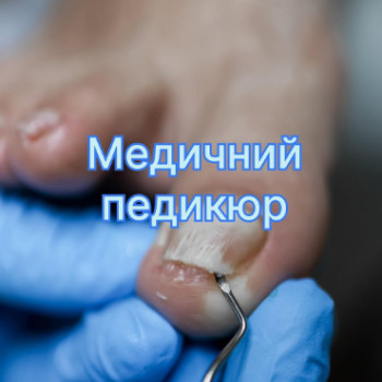 Фото с портфолио Татьяна Сметанка