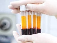 Плазмотерапія 1 пробірка Врач-косметолог Олеся Музичка Тернополь