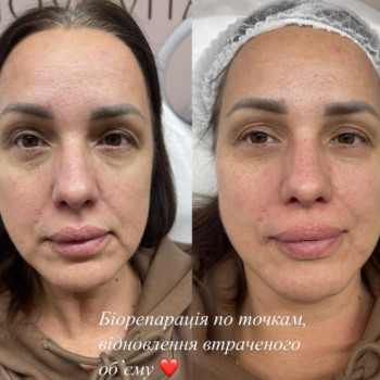 Фото с портфолио Вита Шинькарук